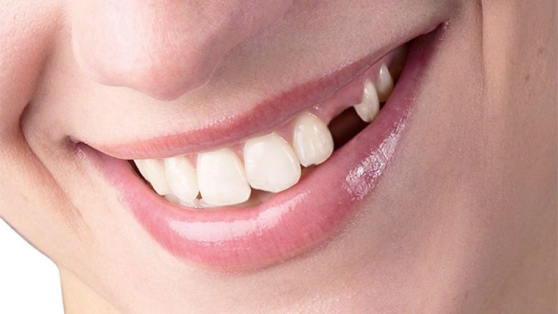 Pasted 86 Ý nghĩa của những giấc mộng thấy rụng răng mang đến